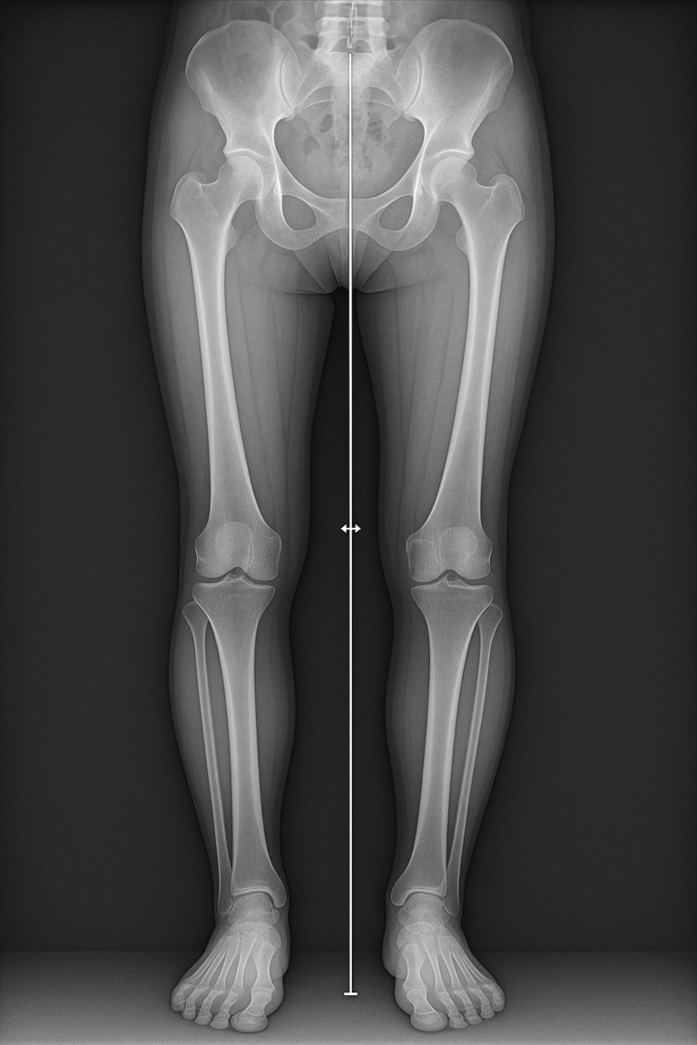 Pangonogramme